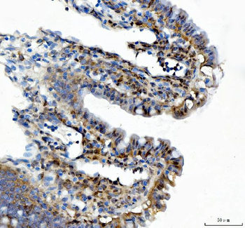 XTP3TPA/DCTPP1 Antibody