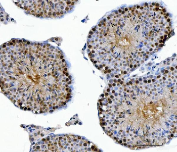 CSNK2A2 Antibody