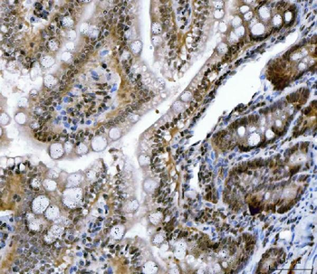 CSNK2A2 Antibody
