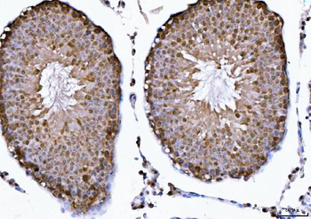 CSNK2A2 Antibody