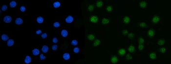 CSNK2A2 Antibody