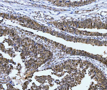 CSNK2A2 Antibody