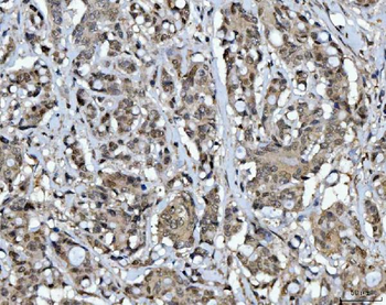 CSNK2A2 Antibody