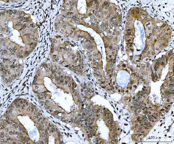 CSNK2A2 Antibody