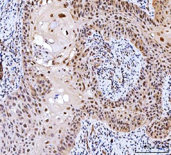 CSNK2A2 Antibody