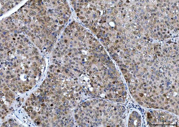 CSNK2A2 Antibody