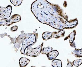 CSNK2A2 Antibody