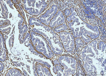 Collagen VI/COL6A2 Antibody