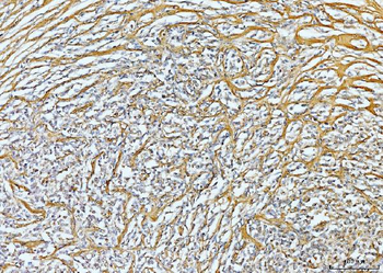 Collagen VI/COL6A2 Antibody