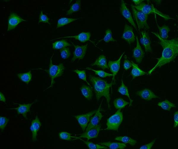 Chromogranin A/Chga Rabbit Polyclonal Antibody