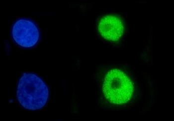CBX2 Rabbit Polyclonal Antibody