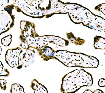 CBX2 Rabbit Polyclonal Antibody