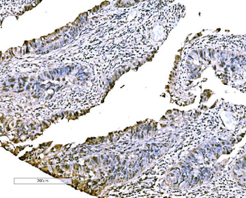 CBX2 Rabbit Polyclonal Antibody