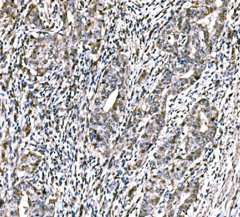 CBX2 Rabbit Polyclonal Antibody