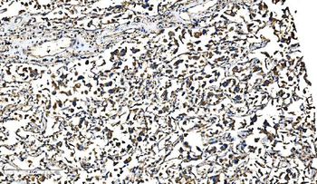 Bim/BCL2L11 Antibody