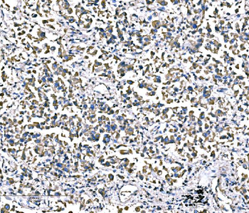 ATG16L1 Antibody