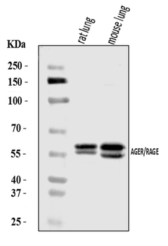 RAGE/AGER Antibody