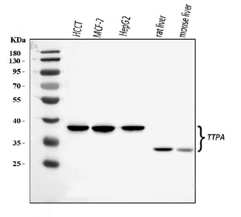 TTPA/TPP1 Antibody
