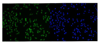 PRMT3 Rabbit Polyclonal Antibody