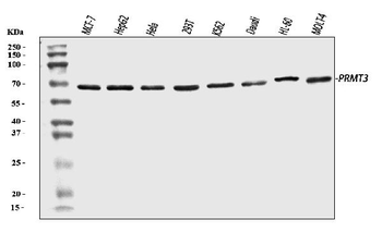 PRMT3 Rabbit Polyclonal Antibody