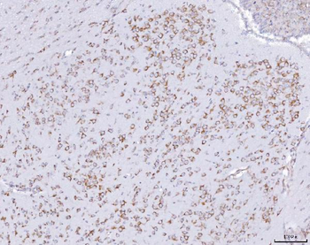 PRKRA Antibody