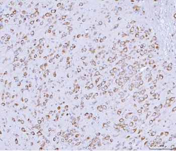 PRKRA Antibody