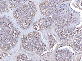 Pleckstrin/PLEK Rabbit Polyclonal Antibody