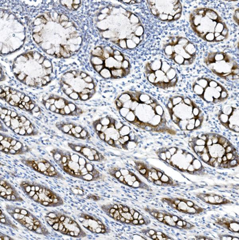 MUC5B Rabbit Polyclonal Antibody