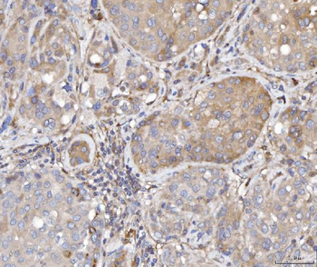 TTC11/FIS1 Antibody