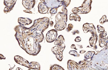 TTC11/FIS1 Antibody