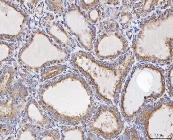 TTC11/FIS1 Antibody