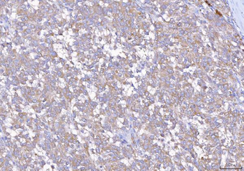 EIF5A Antibody