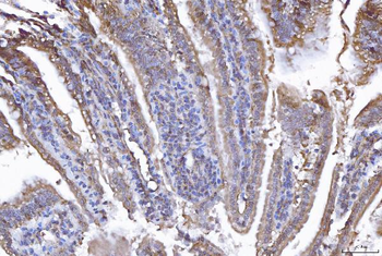 EIF5A Antibody
