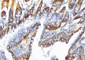 EIF5A Antibody