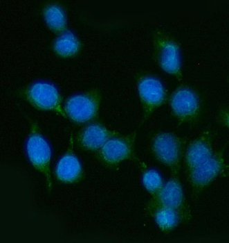 PP11/ENDOU Rabbit Polyclonal Antibody