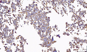 PP11/ENDOU Rabbit Polyclonal Antibody