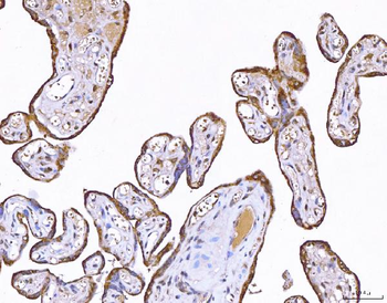 PP11/ENDOU Rabbit Polyclonal Antibody