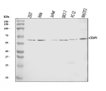 CENPI Rabbit Polyclonal Antibody
