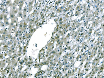 CD101 Rabbit Polyclonal Antibody