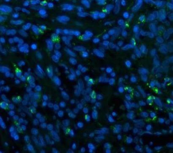 CD68 Antibody