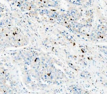 CD68 Antibody