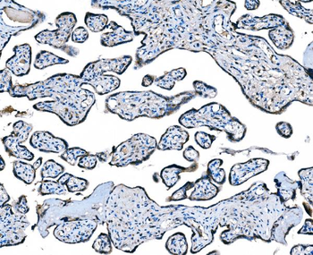 CCR2 Antibody