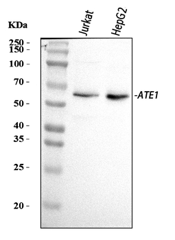 ATE1 Rabbit Polyclonal Antibody