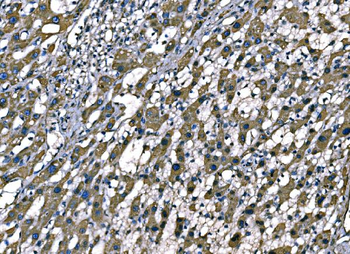SOD2 Mouse Monoclonal Antibody