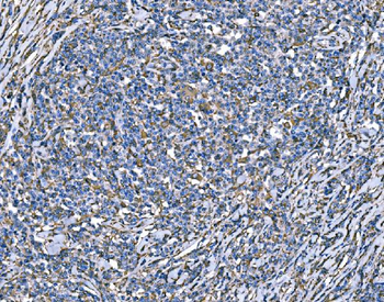 SOD2 Mouse Monoclonal Antibody
