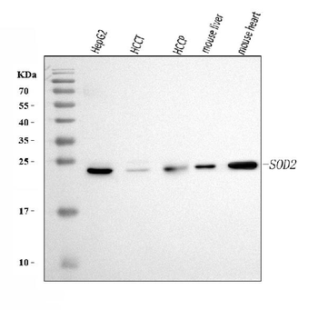 SOD2 Mouse Monoclonal Antibody