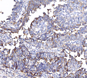 CD55 Antibody (monoclonal, 5B9E1)