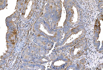 CD55 Antibody (monoclonal, 5B9E1)