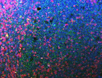 CD20 Mouse Monoclonal Antibody