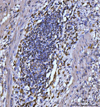 CD20 Mouse Monoclonal Antibody